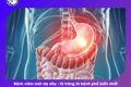 Chế độ dinh dưỡng cho người bệnh viêm loét dạ dày, tá tràng