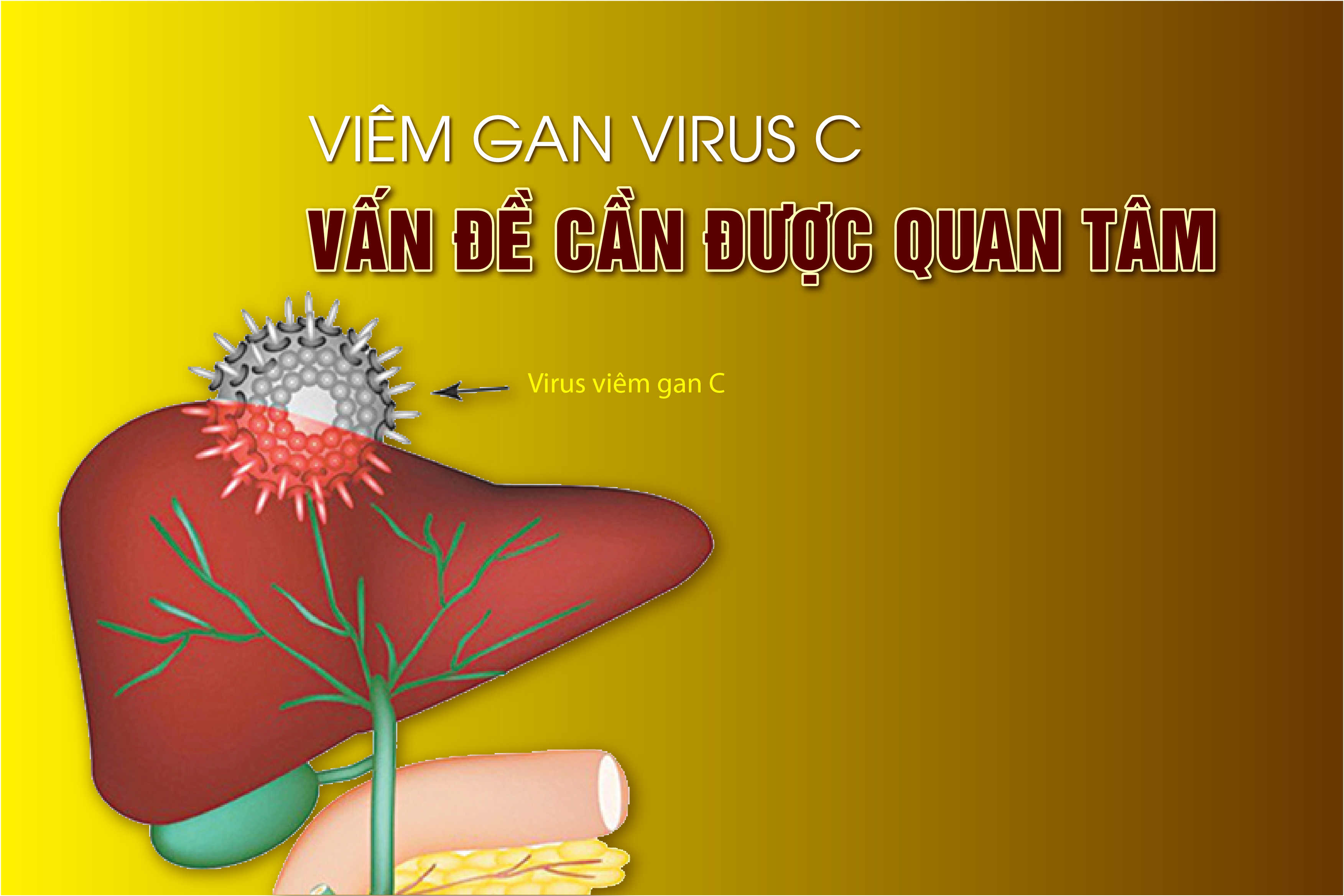 Viêm gan Virus C - Vấn đề cần được quan tâm