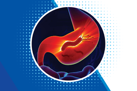 Đồng thuận chẩn đoán và điều trị nhiễm Helicobacter pylori