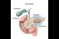 INSULINOMA Hướng tiếp cận mới
