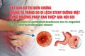 Kết quả xử trí biến chứng thủng tá tràng do di lệch stent đường mật bằng phương pháp can thiệp qua nội soi – Ca lâm sàng