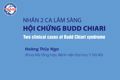 Nhận 2 ca lâm sàng hội chứng Budd Chiari