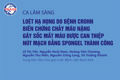 Ca lâm sàng: Loét hạ họng do bệnh Crohn biến chứng chảy máu nặng gây sốc mất máu được can thiệp nút mạch bằng Spongel thành công